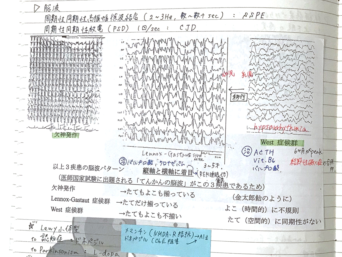 第113回医師国家試験【体験記】手を動かすことで覚える！ 直前期“書く