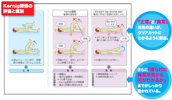 『診察と手技がみえる』Kernig徴候の評価と鑑別 紙面