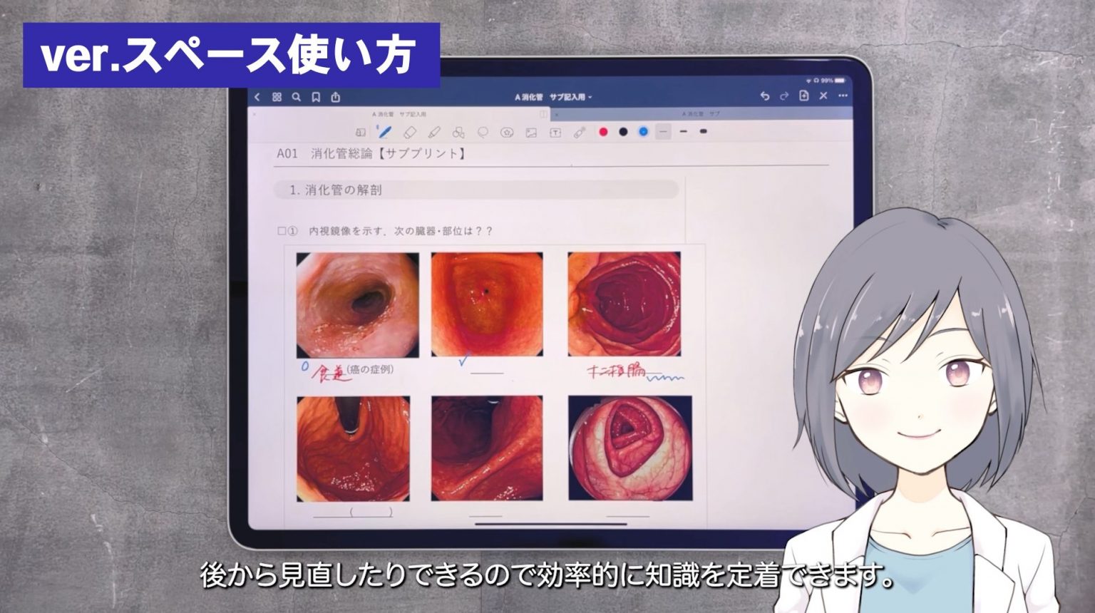 QAssist【体験記】サブプリントの使い方！ INFORMA by メディックメディア