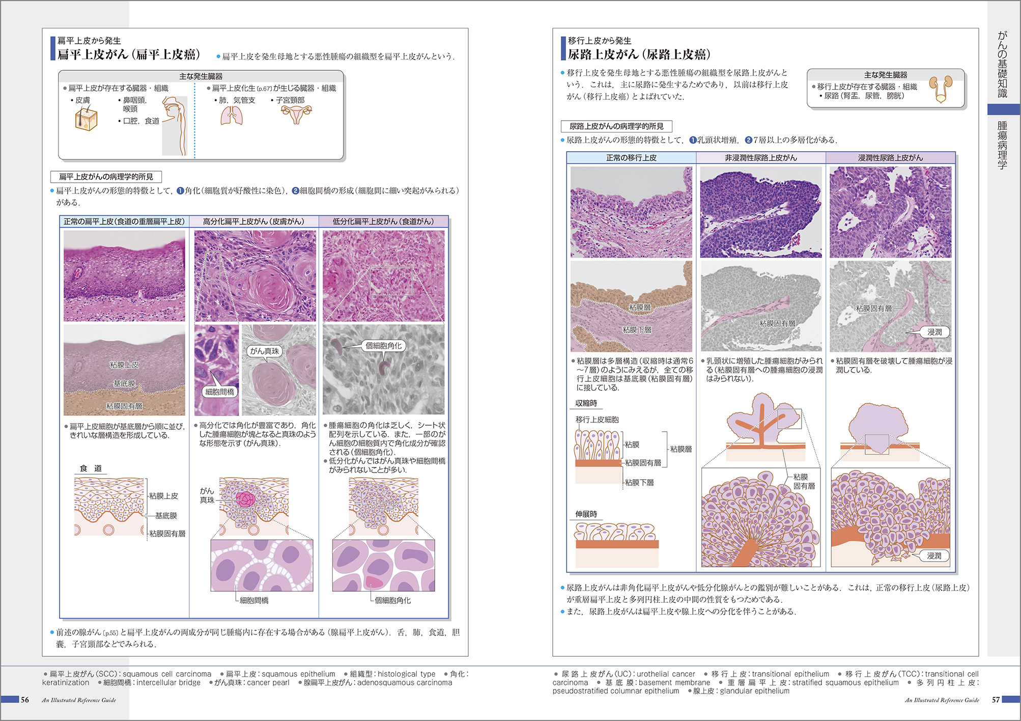 『がんがみえる』 紙面イメージ
病理学 腫瘍病理
扁平上皮癌 扁平上皮がん 尿路上皮がん
移行上皮癌