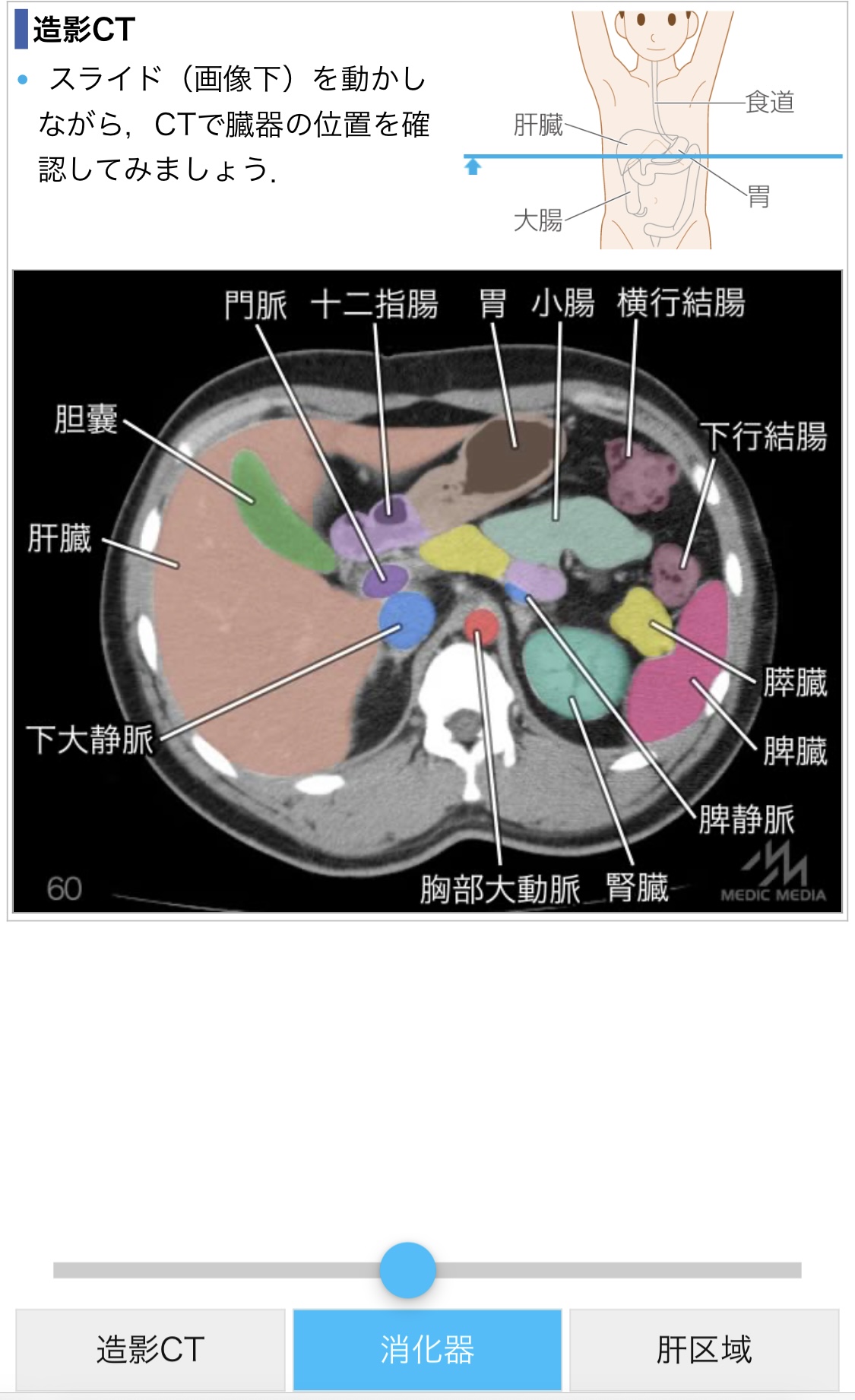 腹部の造影CT