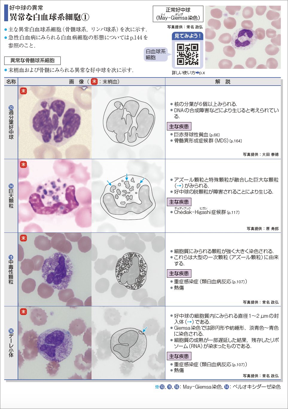 異常な白血球系細胞