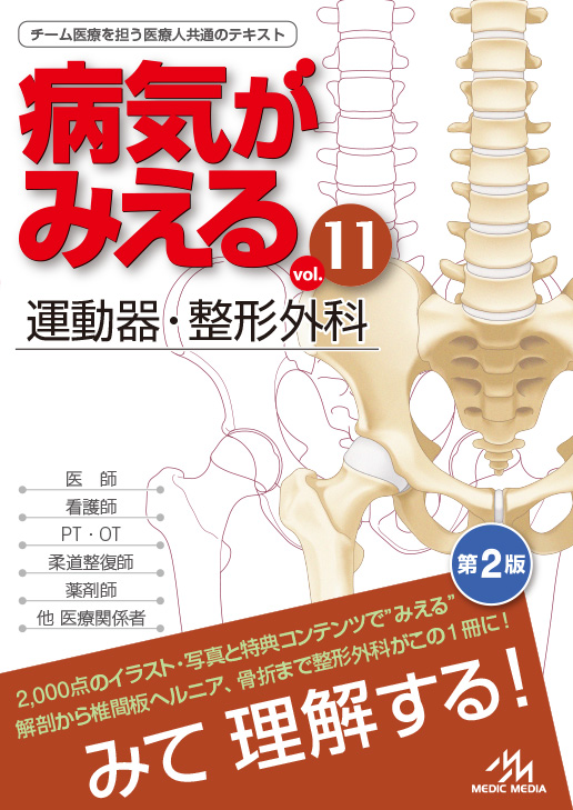 病気がみえるvol.11 運動器・整形外科』第2版 2024年1月23日発売 