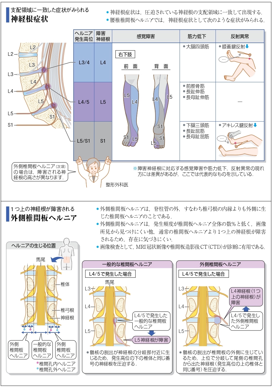 病気がみえるvol.11 運動器・整形外科（第2版）』 改訂ポイント紹介 