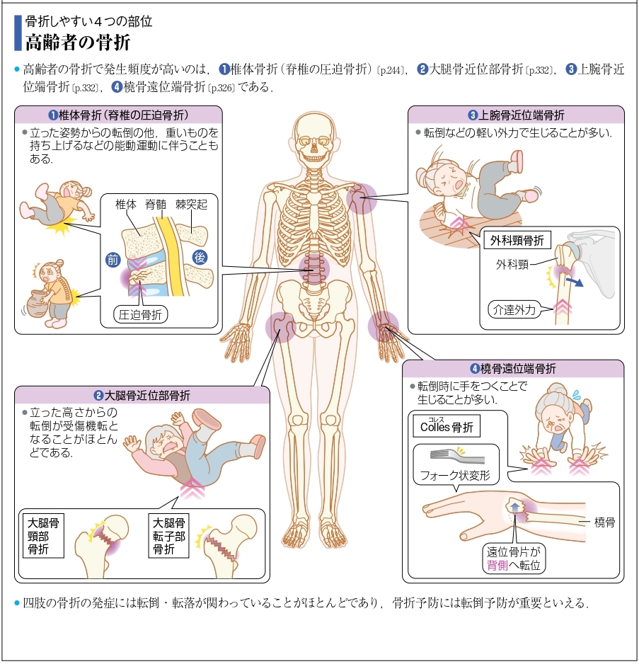 病気がみえるvol.11 運動器・整形外科（第2版）』 改訂ポイント紹介 