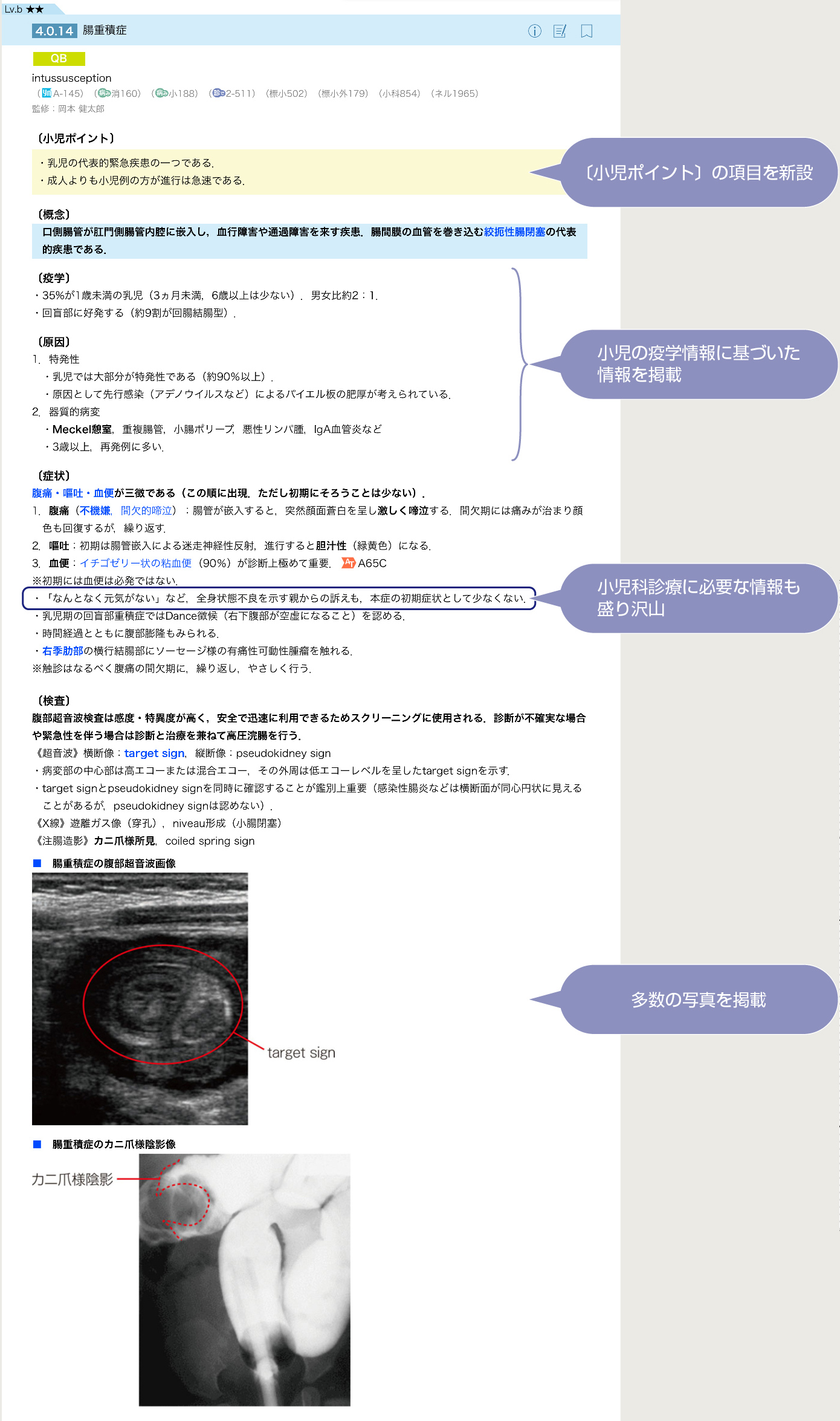 イヤーノート小児科　小児ポイント