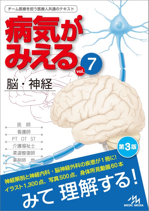 『病気がみえるvol.7 脳・神経』第3版
