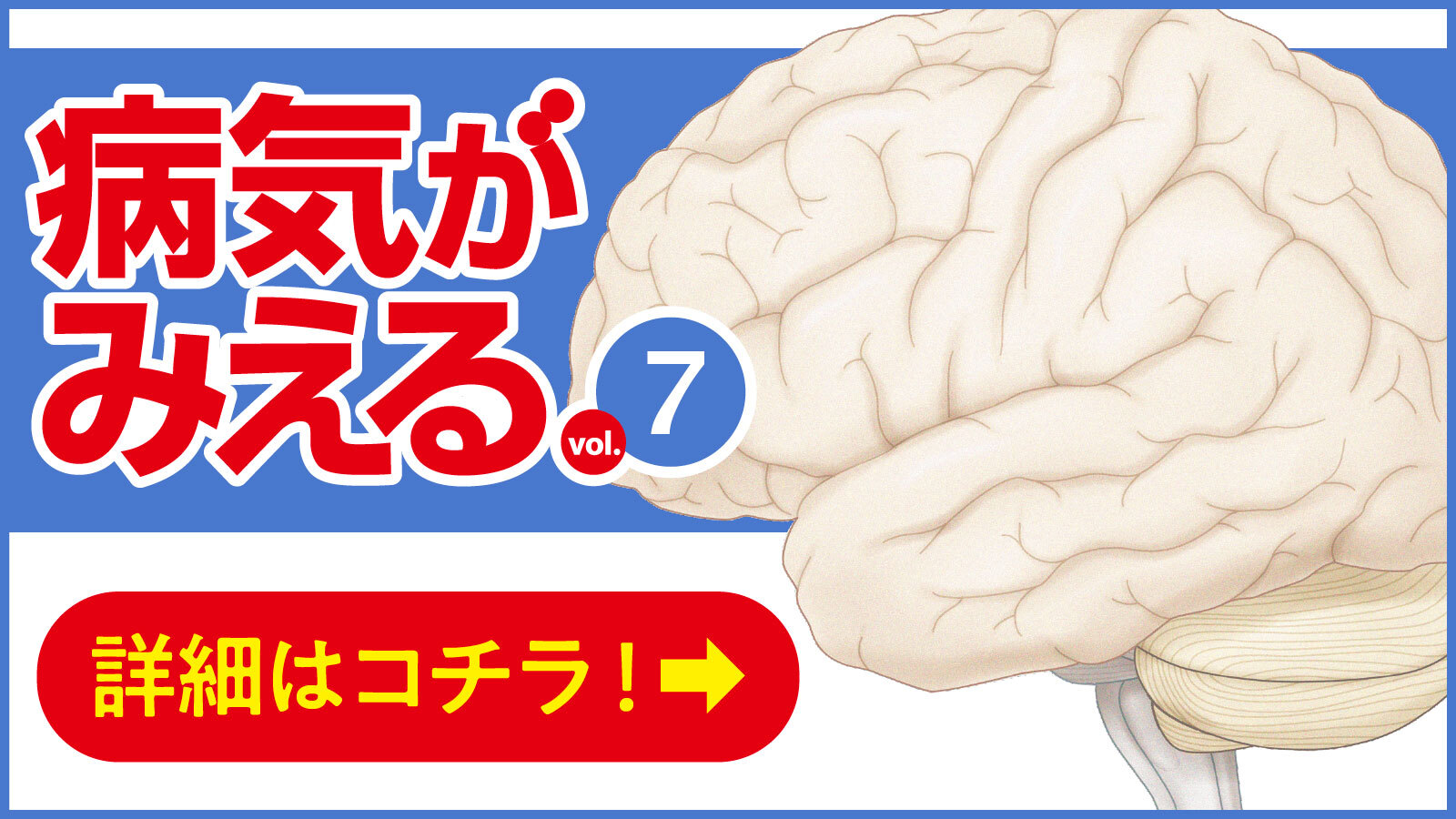 『病気がみえるvol.7 脳・神経』第3版 WEBページ